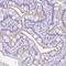 Zinc Finger Protein 319 antibody, HPA052584, Atlas Antibodies, Immunohistochemistry paraffin image 