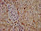 Coproporphyrinogen Oxidase antibody, LS-C674957, Lifespan Biosciences, Immunohistochemistry paraffin image 