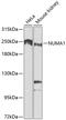 Nuclear Mitotic Apparatus Protein 1 antibody, 13-194, ProSci, Western Blot image 