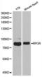 X-linked retinitis pigmentosa GTPase regulator antibody, LS-C331722, Lifespan Biosciences, Western Blot image 