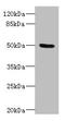 Protein Tyrosine Phosphatase Non-Receptor Type 18 antibody, LS-C676335, Lifespan Biosciences, Western Blot image 