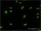U2 Small Nuclear RNA Auxiliary Factor 2 antibody, H00011338-M03, Novus Biologicals, Immunocytochemistry image 