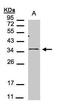 C-X-C Motif Chemokine Receptor 6 antibody, PA5-27171, Invitrogen Antibodies, Western Blot image 