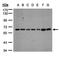 1,25-dihydroxyvitamin D(3) 24-hydroxylase, mitochondrial antibody, orb69980, Biorbyt, Western Blot image 