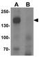 Leucyl And Cystinyl Aminopeptidase antibody, GTX32096, GeneTex, Western Blot image 