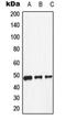 Dopamine Receptor D1 antibody, orb213857, Biorbyt, Western Blot image 