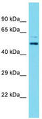 MINDY Lysine 48 Deubiquitinase 3 antibody, TA343239, Origene, Western Blot image 