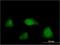 NUAK Family Kinase 2 antibody, H00081788-M04, Novus Biologicals, Immunocytochemistry image 