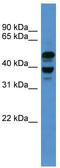 Activating Signal Cointegrator 1 Complex Subunit 1 antibody, TA345093, Origene, Western Blot image 