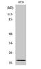 Mitochondrial Ribosomal Protein L18 antibody, A13607-1, Boster Biological Technology, Western Blot image 