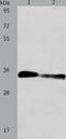 Aspartoacylase-2 antibody, TA322092, Origene, Western Blot image 