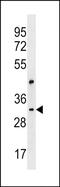 Cep170-like protein antibody, PA5-49088, Invitrogen Antibodies, Western Blot image 