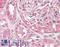 BCAM antibody, LS-B11547, Lifespan Biosciences, Immunohistochemistry paraffin image 