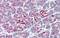 Zinc transporter ZIP5 antibody, 25-932, ProSci, Immunohistochemistry paraffin image 