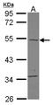 TBC1 Domain Family Member 10C antibody, LS-C155640, Lifespan Biosciences, Western Blot image 