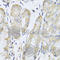 FA Complementation Group A antibody, A7671, ABclonal Technology, Immunohistochemistry paraffin image 