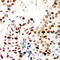 Zinc Finger Protein 75D antibody, LS-C368559, Lifespan Biosciences, Immunohistochemistry paraffin image 