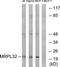 Mitochondrial Ribosomal Protein L14 antibody, TA315759, Origene, Western Blot image 