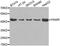 Pro-Apoptotic WT1 Regulator antibody, A3063, ABclonal Technology, Western Blot image 