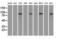 Catenin Beta 1 antibody, LS-C114411, Lifespan Biosciences, Western Blot image 