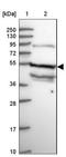 Solute Carrier Family 38 Member 9 antibody, NBP1-92403, Novus Biologicals, Western Blot image 