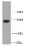 FAM20A Golgi Associated Secretory Pathway Pseudokinase antibody, FNab02978, FineTest, Western Blot image 