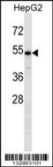 Carbohydrate Sulfotransferase 9 antibody, 56-908, ProSci, Western Blot image 