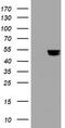 Thymidine Phosphorylase antibody, TA800998AM, Origene, Western Blot image 