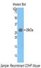 Cadherin-3 antibody, LS-C304050, Lifespan Biosciences, Western Blot image 