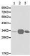 CD99 Molecule (Xg Blood Group) antibody, TA323795, Origene, Western Blot image 