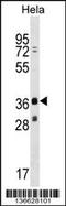 MAGE Family Member B16 antibody, 58-841, ProSci, Western Blot image 