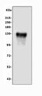 Desmoglein 3 antibody, PA1567, Boster Biological Technology, Western Blot image 
