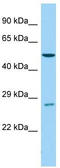Cytochrome P450 Family 4 Subfamily B Member 1 antibody, TA346228, Origene, Western Blot image 