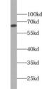 Sodium Channel Epithelial 1 Alpha Subunit antibody, FNab07648, FineTest, Western Blot image 