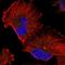 Regulator Of Microtubule Dynamics 1 antibody, HPA026495, Atlas Antibodies, Immunofluorescence image 