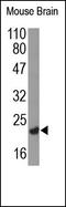 Neurturin antibody, 250793, Abbiotec, Western Blot image 