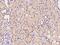 Chitinase 3 Like 2 antibody, 201462-T08, Sino Biological, Immunohistochemistry frozen image 