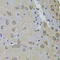 Gm13125 antibody, 14-546, ProSci, Immunohistochemistry paraffin image 