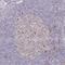 Derlin 2 antibody, NBP2-49231, Novus Biologicals, Immunohistochemistry paraffin image 
