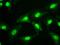Small RNA Binding Exonuclease Protection Factor La antibody, MA5-24921, Invitrogen Antibodies, Immunocytochemistry image 