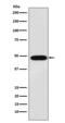 Melanoma-associated antigen 1 antibody, M03570-1, Boster Biological Technology, Western Blot image 