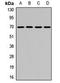 Kelch Like Family Member 9 antibody, orb411680, Biorbyt, Western Blot image 