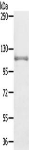 Centrobin, Centriole Duplication And Spindle Assembly Protein antibody, TA349815, Origene, Western Blot image 