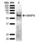 Matrix metalloproteinase-9 antibody, SPC-756D-A390, StressMarq, Western Blot image 