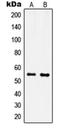 Inositol-Pentakisphosphate 2-Kinase antibody, orb215268, Biorbyt, Western Blot image 