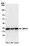 UMP/CMPK antibody, A305-461A, Bethyl Labs, Western Blot image 