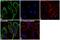 B-Raf Proto-Oncogene, Serine/Threonine Kinase antibody, MA5-15317, Invitrogen Antibodies, Immunofluorescence image 