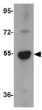 Probable lysosomal cobalamin transporter antibody, GTX85141, GeneTex, Western Blot image 