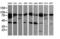 Catenin Beta 1 antibody, LS-C172669, Lifespan Biosciences, Western Blot image 