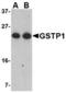Glutathione S-transferase P 1 antibody, TA306508, Origene, Western Blot image 